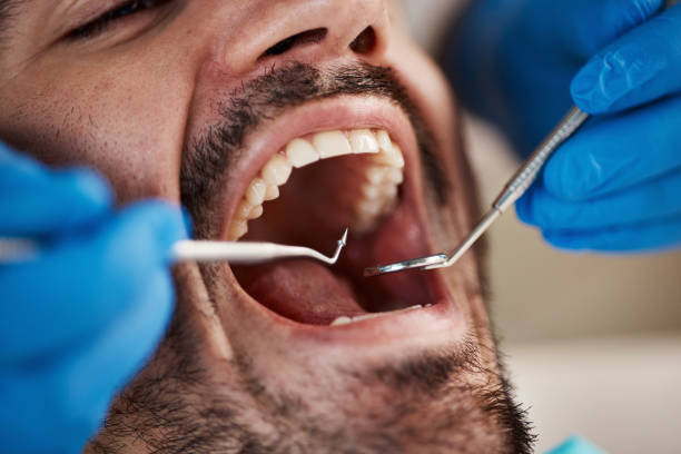 Best Urgent Care for Lost Fillings or Crowns in Oriole Beach, FL